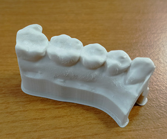 Modello ortodontico in resina biocompatibile LCD